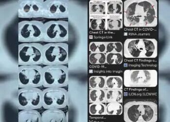 MP में कोरोना वायरस जैसा संक्रमण, स्ट्रेन में बदलाव