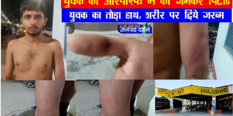 महिला डिब्बा में सफर करने चढ़े युवक के साथ आर पी एफ जवान ने की जमकर पिटाई : हाथ तोड़ा